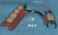 レジン床　部分入れ歯